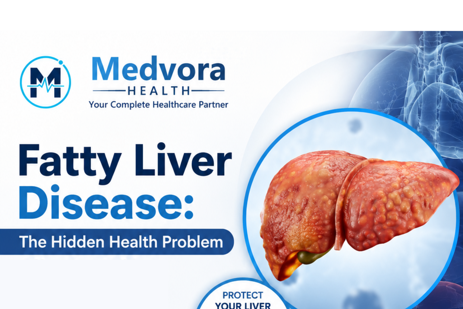 Fatty Liver Disease: The Hidden Health Problem Affecting Millions